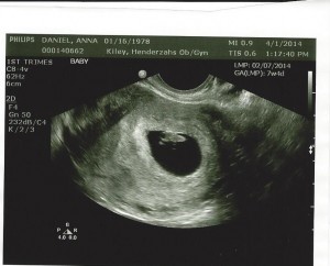 Sweet peanut with a strong heartbeat at 140 bpm.